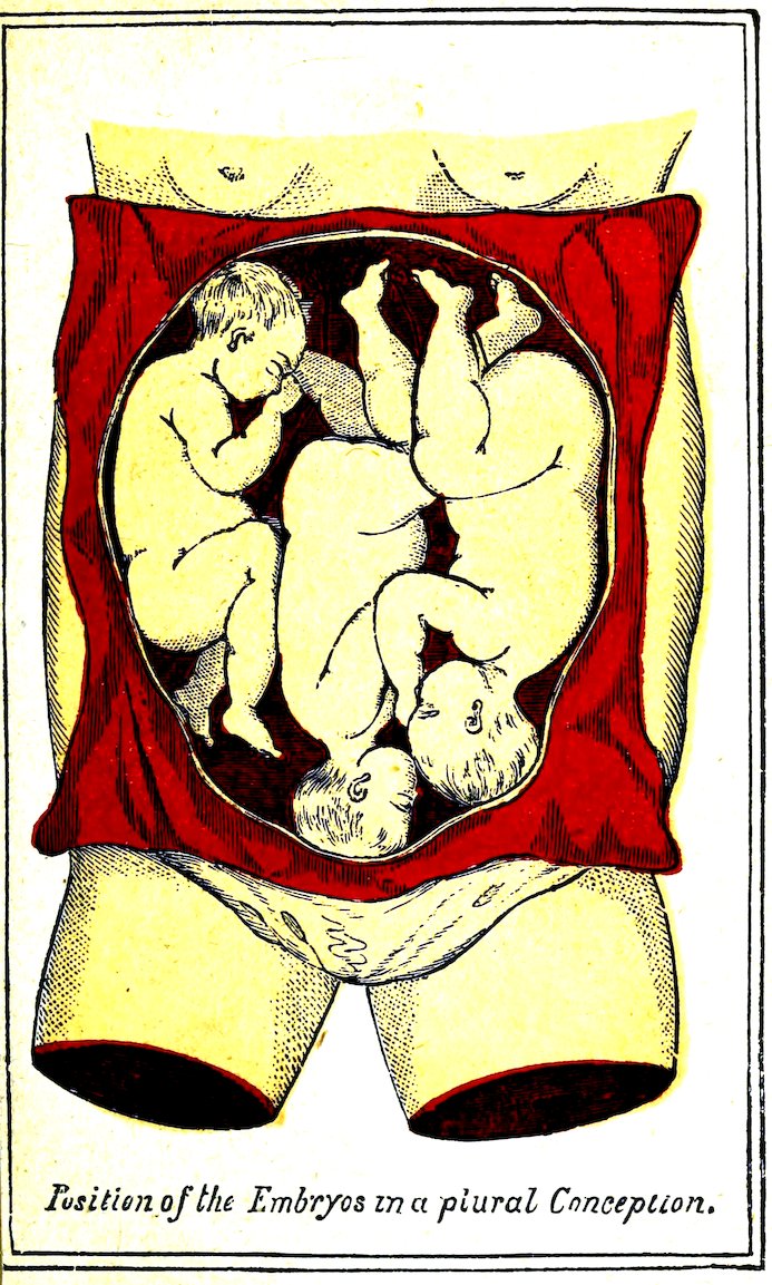 _Position of the Embryos in a plural Conception._