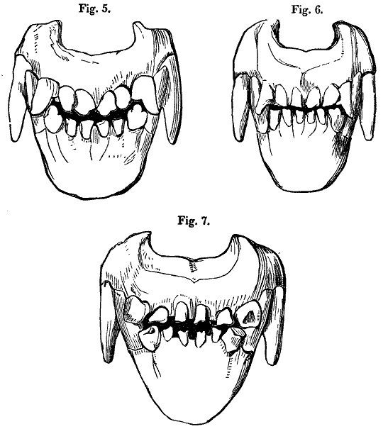 canine teeth in various stages, cont.